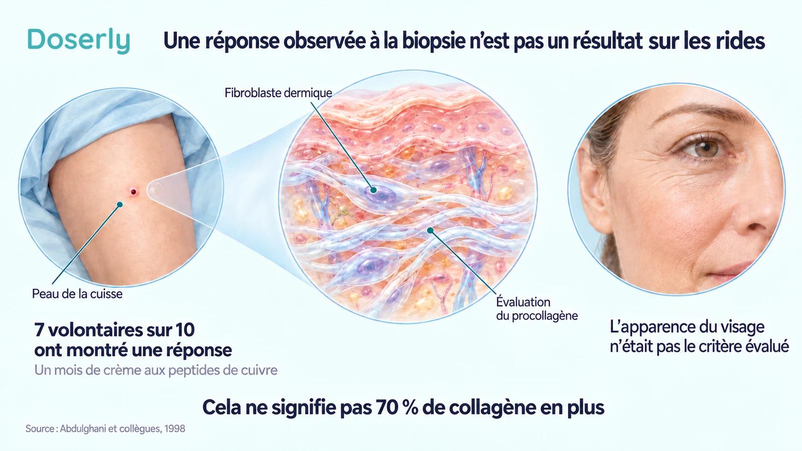 Une illustration de prélèvement de peau sur la cuisse, à côté de tissu dermique et d’un visage distinct, explique le critère d’évaluation de l’étude de biopsies.