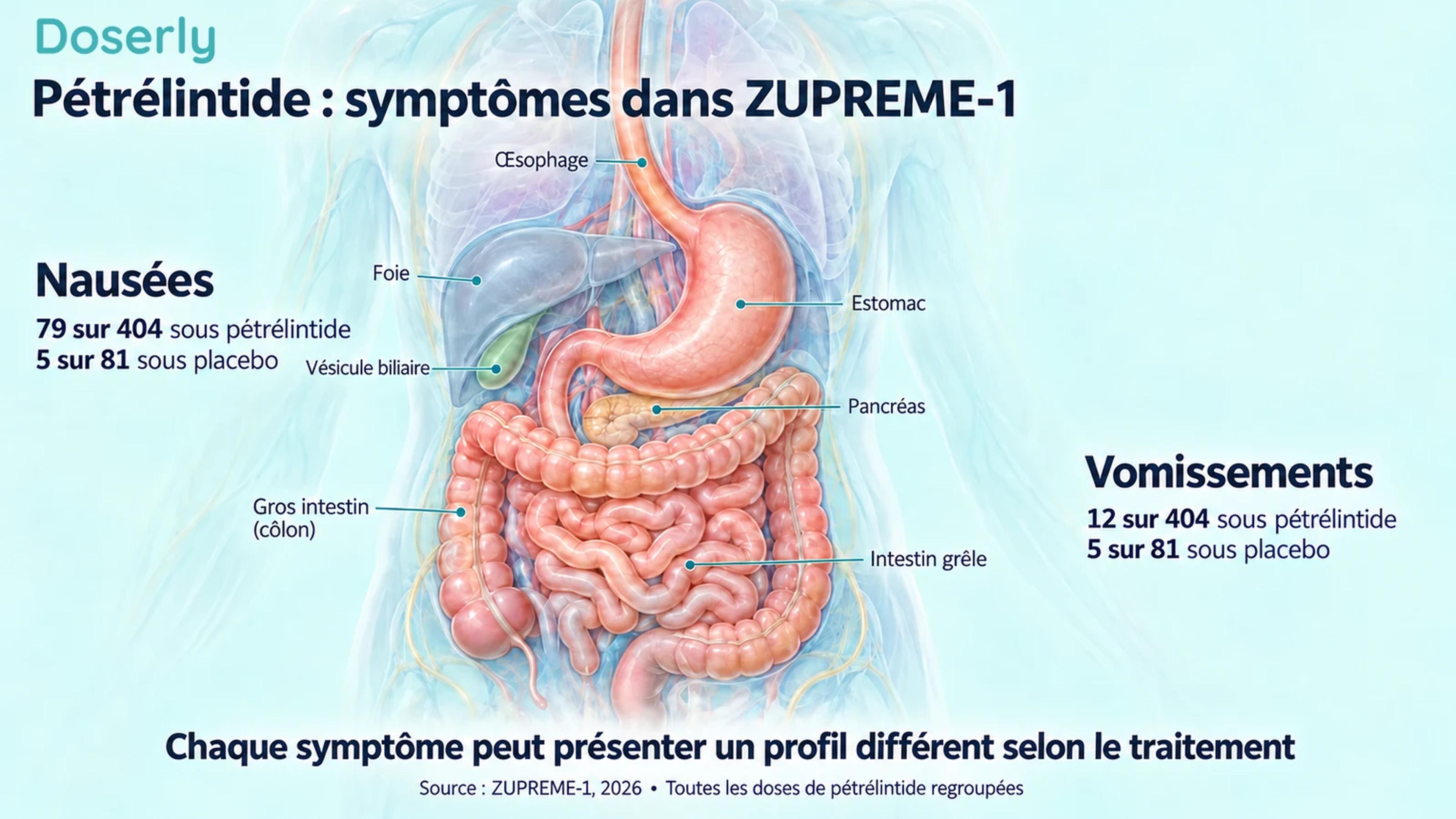 Anatomie digestive à côté des nombres de participants de ZUPREME-1 ayant eu des nausées ou des vomissements sous pétrélintide et sous placebo.