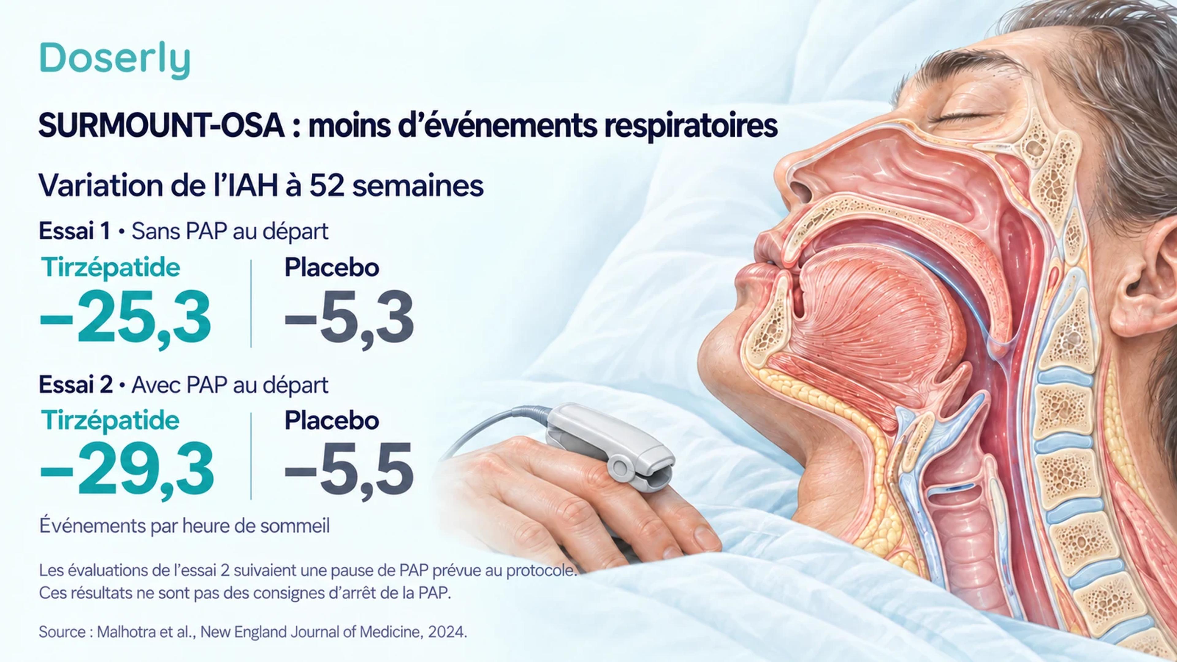 Variations de l’IAH dans les deux essais SURMOUNT-OSA, à côté d’une illustration détaillée des voies aériennes supérieures et d’un capteur d’oxygène au doigt.
