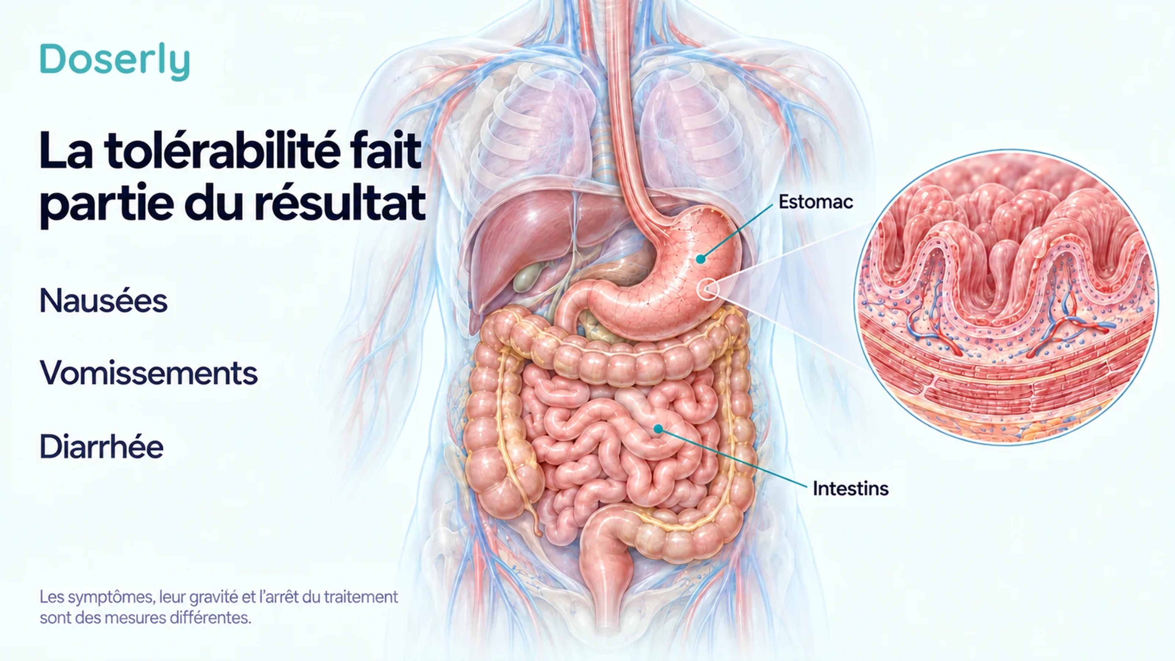 Anatomie détaillée de l’appareil digestif avec des étiquettes pour l’estomac et les intestins et les termes nausées, vomissements et diarrhée, expliquant la différence entre les symptômes et l’arrêt du traitement.