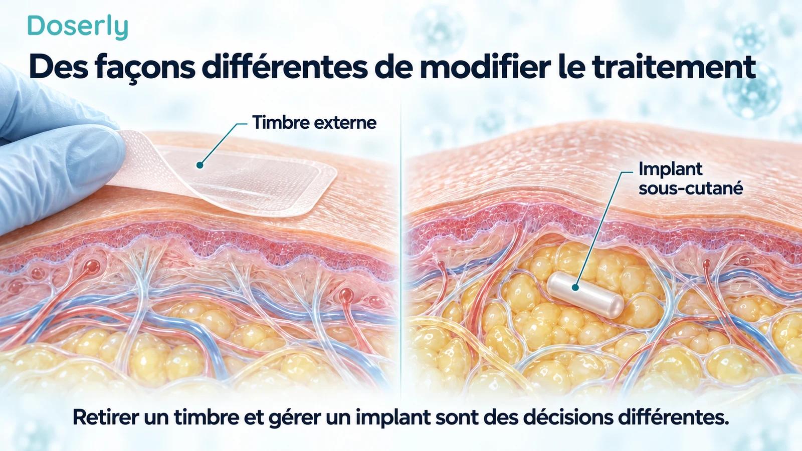 Timbre externe qu’on décolle d’une peau intacte, à côté d’une coupe distincte de la peau contenant un implant.