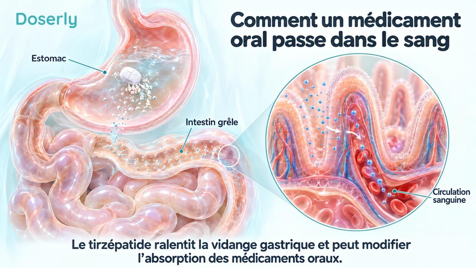 Estomac et villosités intestinales illustrant le passage dans le sang d’un médicament oral dissous.