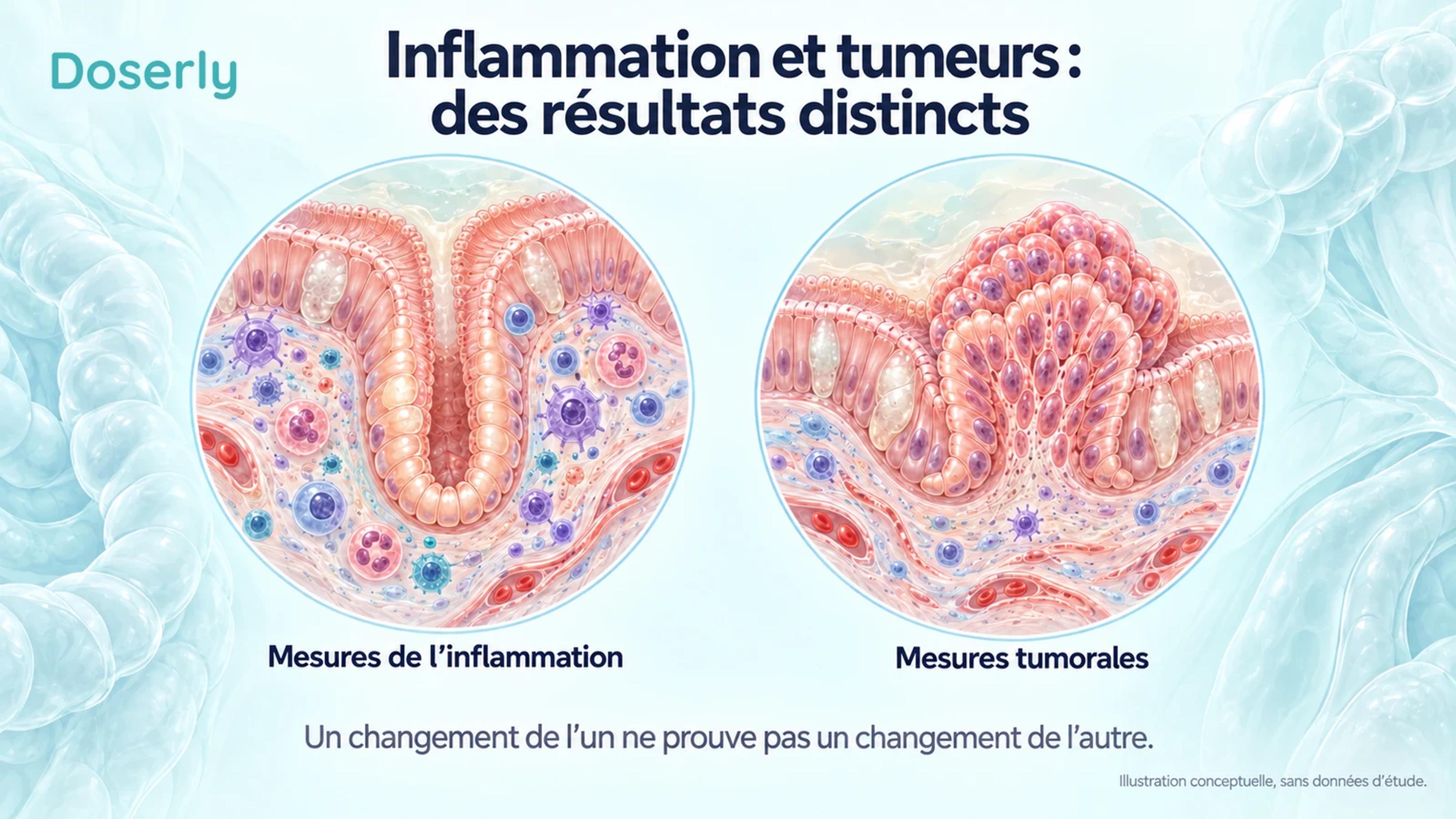 Des illustrations schématiques de tissus intestinaux distinguent les mesures de l’inflammation des mesures tumorales.