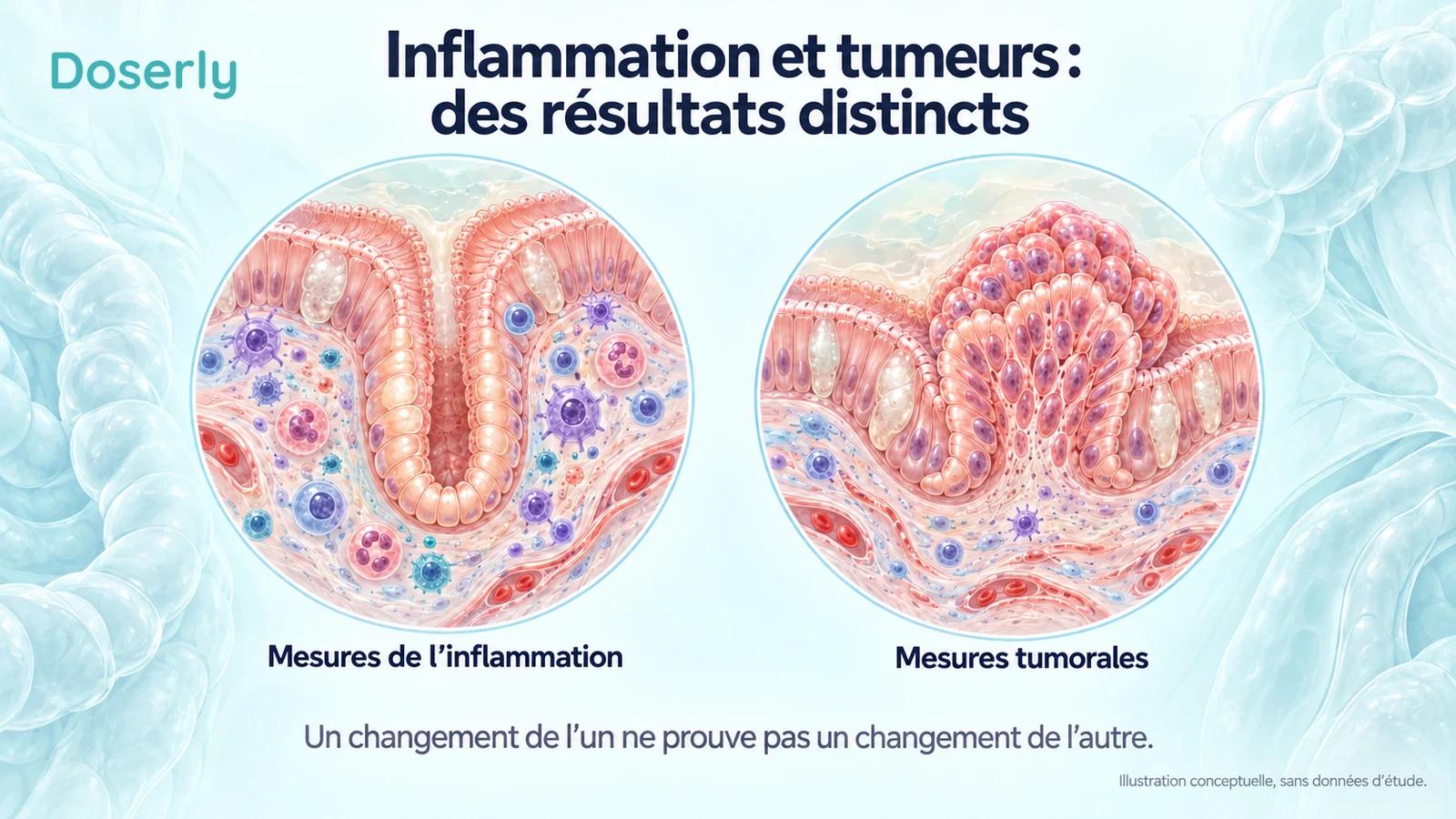 Des illustrations schématiques de tissus intestinaux distinguent les mesures de l’inflammation des mesures tumorales.