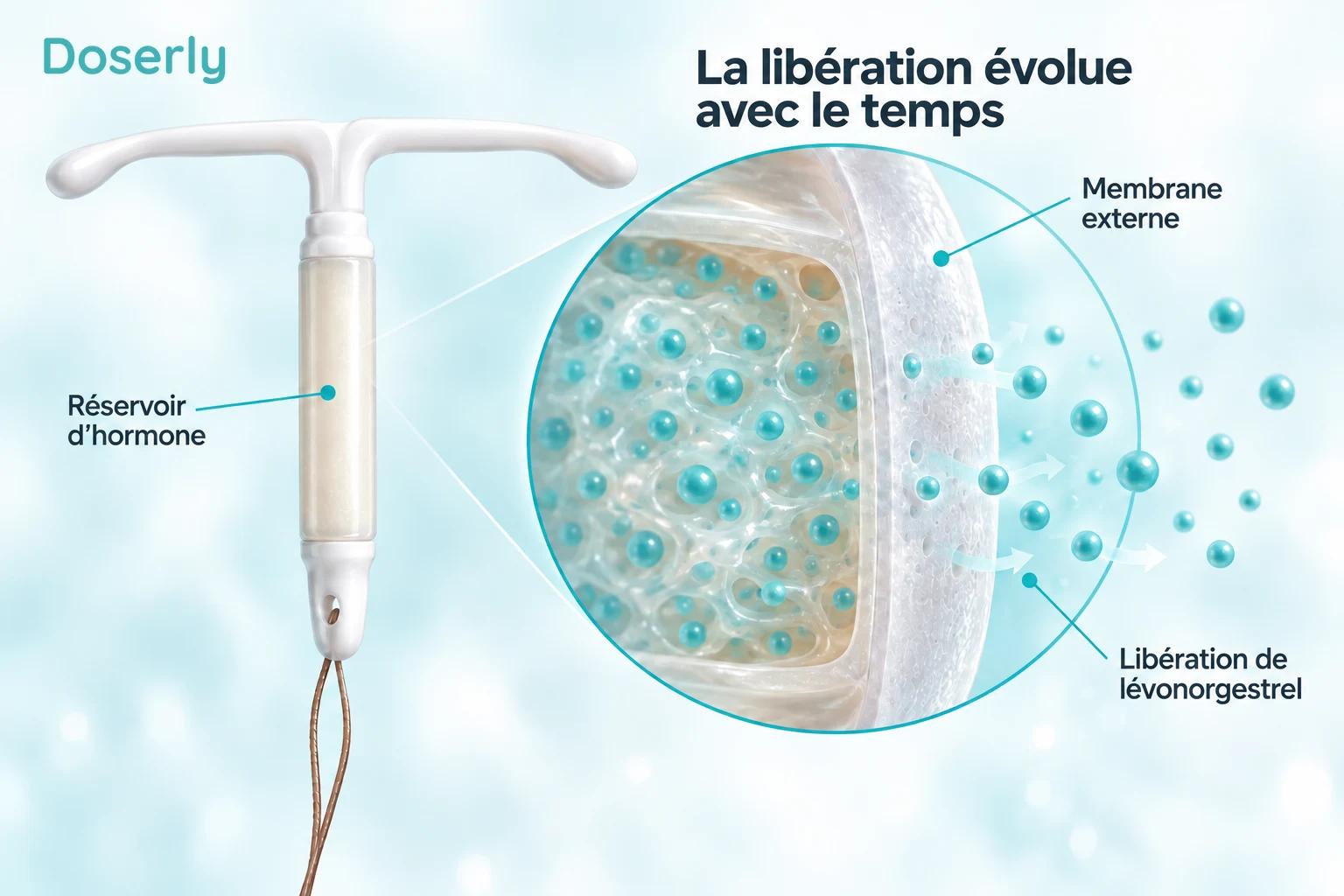 Stérilet hormonal avec un réservoir et une membrane agrandis illustrant la libération du lévonorgestrel.