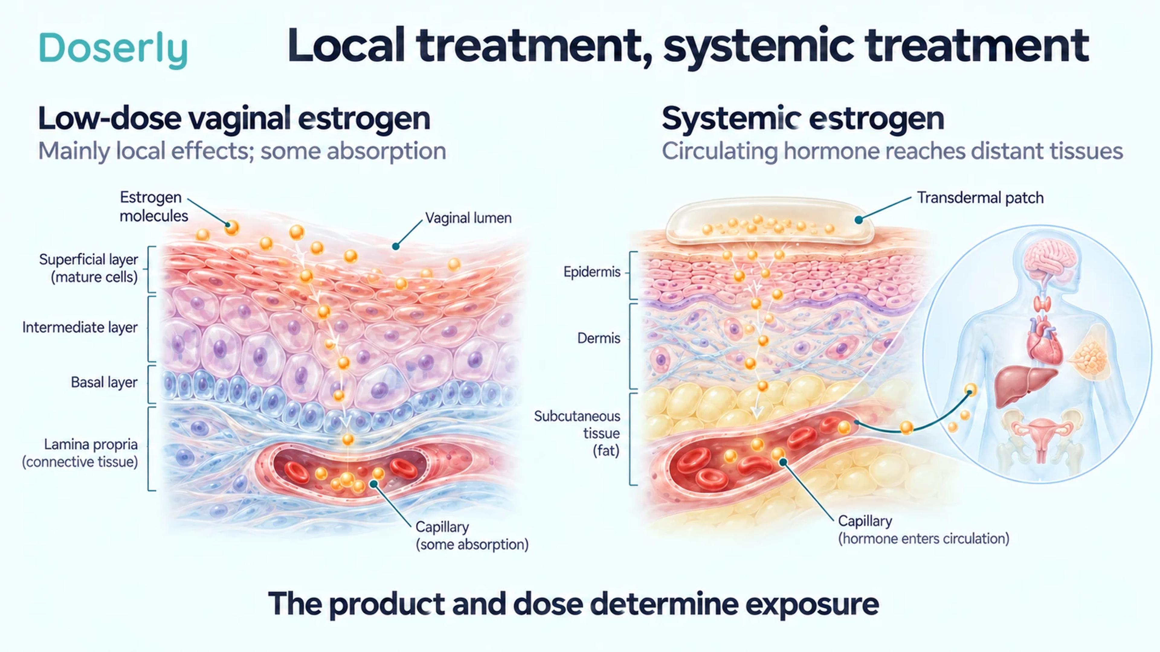 Microscopic vaginal tissue and skin-patch illustrations distinguish mainly local estrogen effects from systemic hormone delivery.