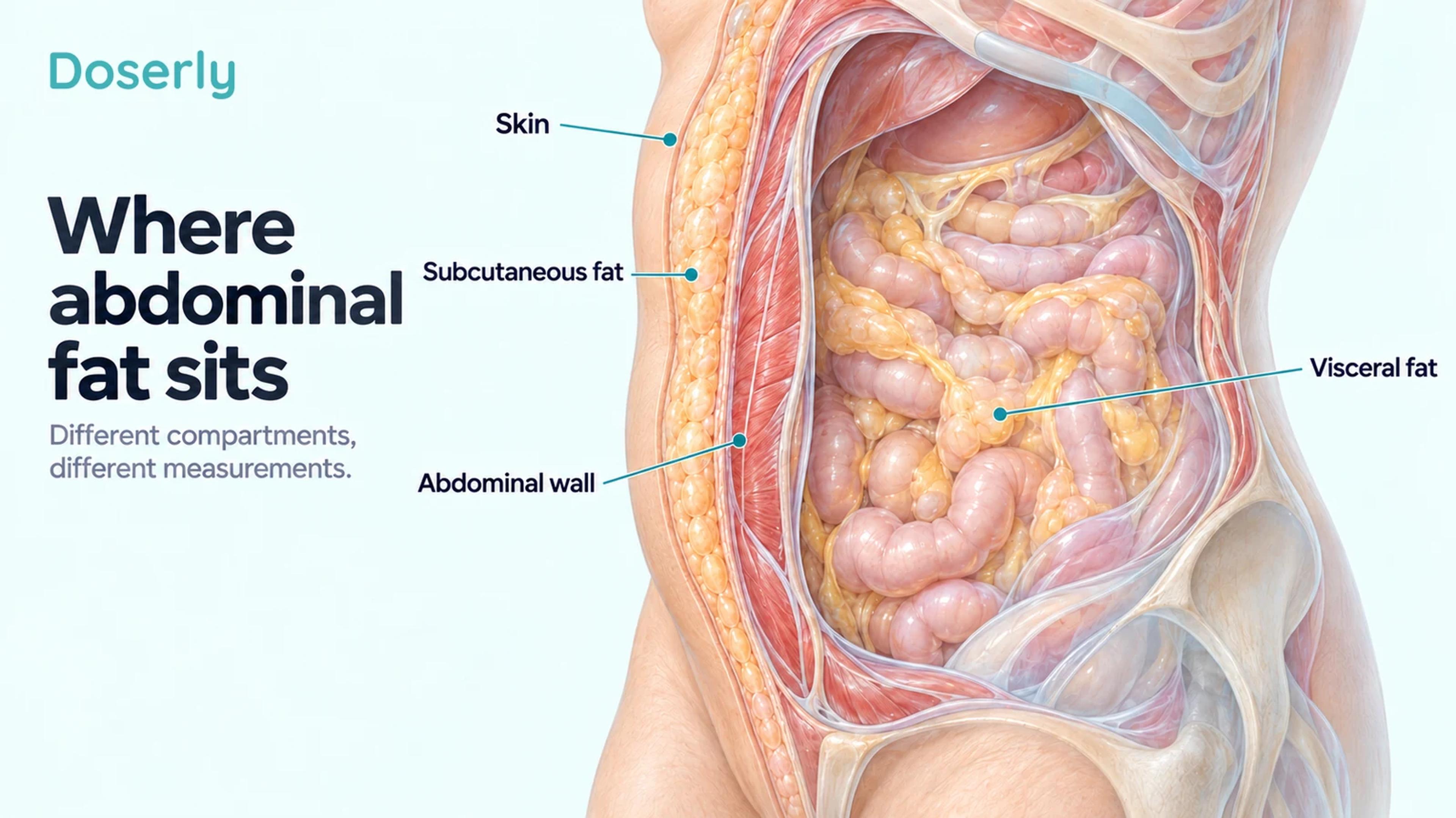 Detailed abdominal cutaway showing subcutaneous fat outside the muscle wall and visceral fat around the bowel