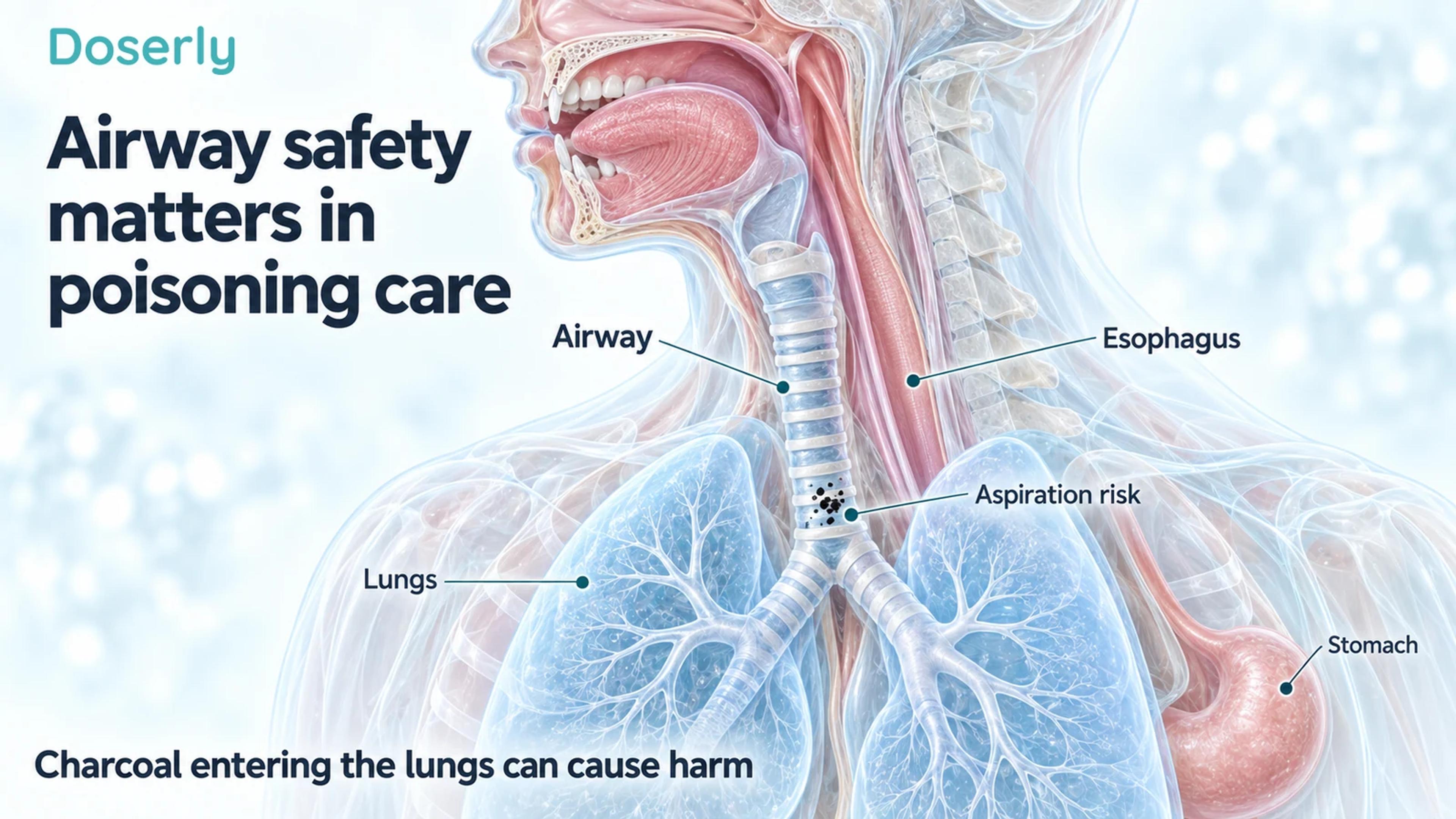 Medical-atlas cutaway separates the ringed airway and lungs from the esophagus, with charcoal specks marking aspiration risk in the airway.