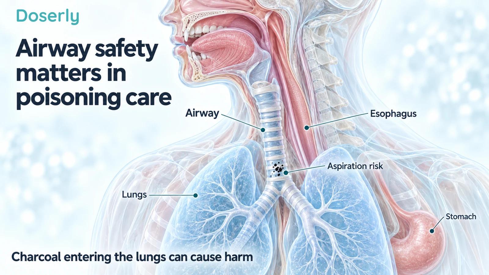 Medical-atlas cutaway separates the ringed airway and lungs from the esophagus, with charcoal specks marking aspiration risk in the airway.