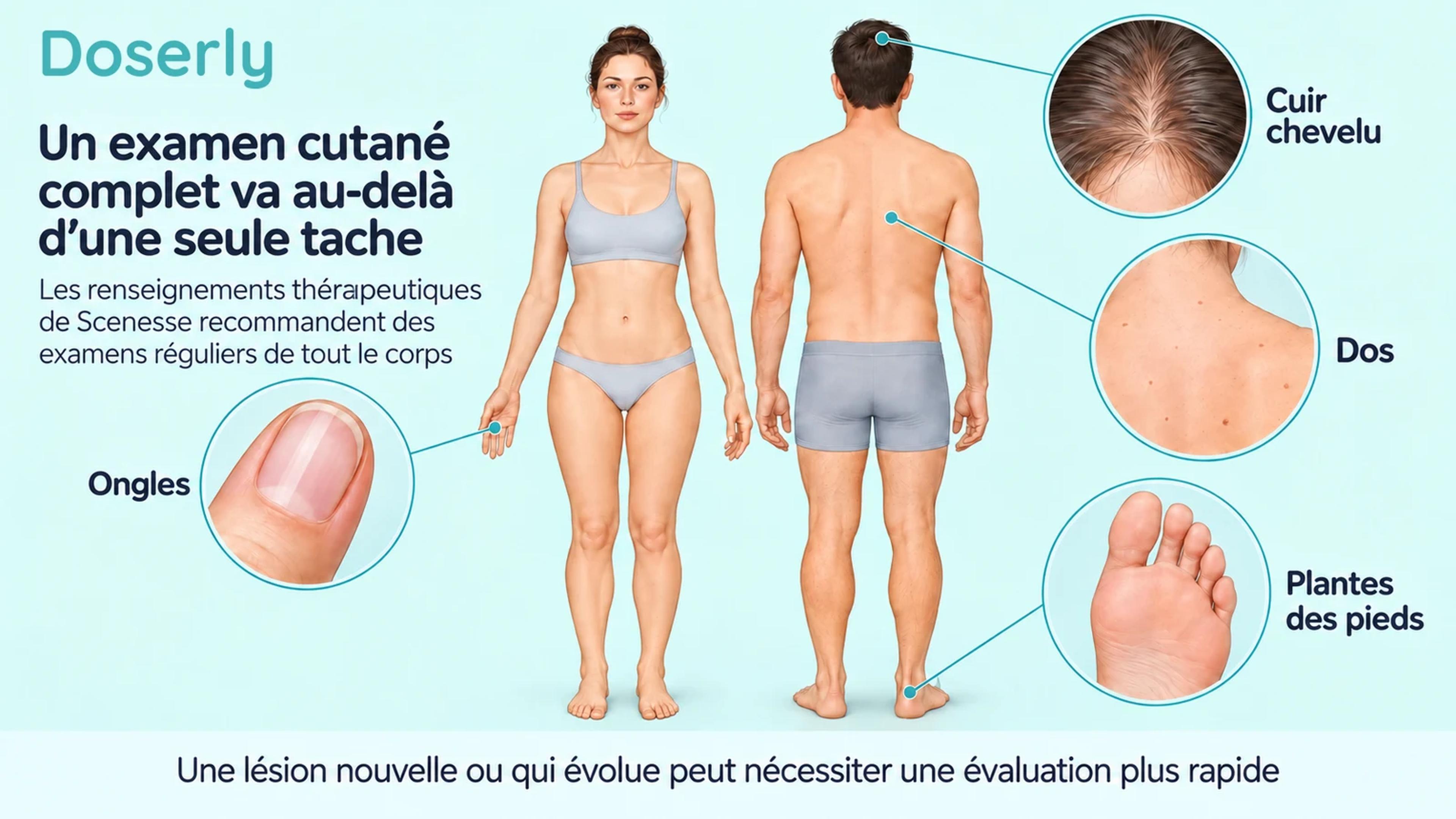 Illustrations du corps de face et de dos, avec des encadrés détaillés du cuir chevelu, de la plante du pied et d’un ongle pour un examen cutané complet.