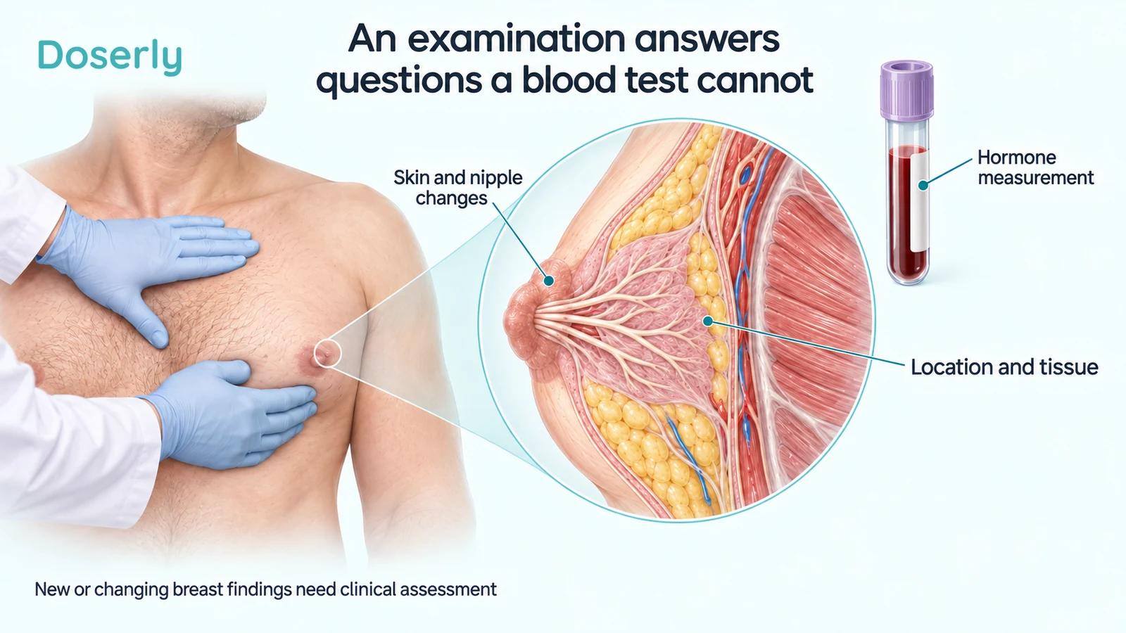 Clinical male breast examination beside a magnified view of subareolar ducts and fibrous stroma and a separate hormone blood sample.