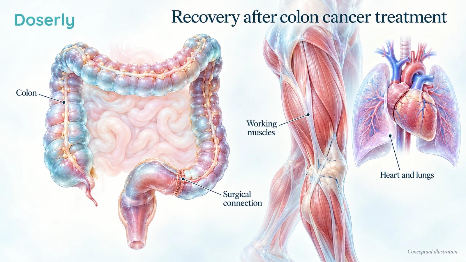 Conceptual colon anatomy after a surgical connection beside leg muscles and the heart and lungs.