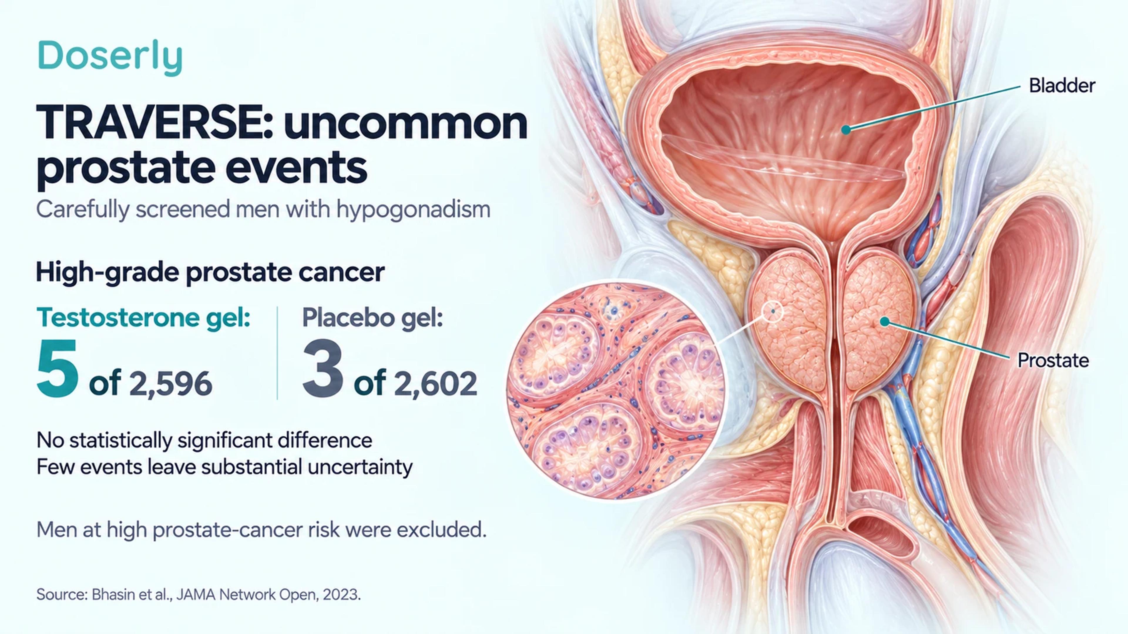 TRAVERSE high-grade prostate cancer counts of five testosterone participants and three placebo participants beside neutral prostate anatomy.