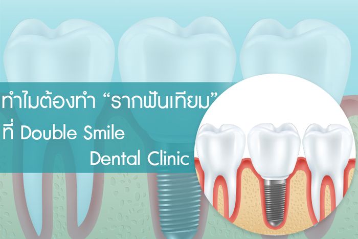ทำไมต้องทำ “รากฟันเทียม” ที่ Double Smile Dental Clinic