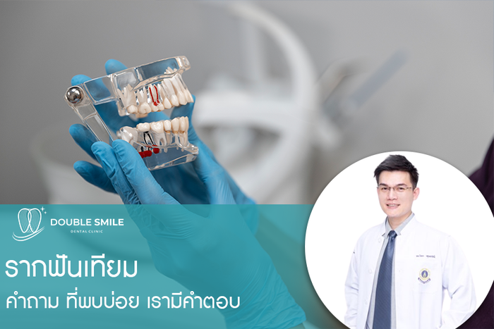 รากฟันเทียมกับ คำถาม ที่พบบ่อย Doublesmiledentalclinic เรามีคำตอบ