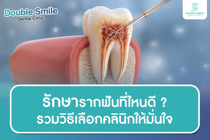 รักษารากฟันที่ไหนดี ? รวมวิธีเลือกคลินิกให้มั่นใจ