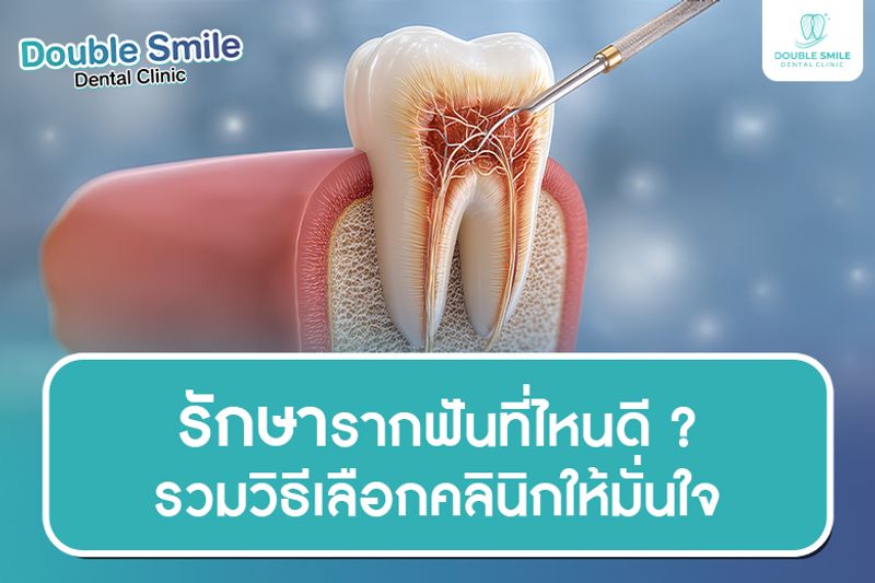 รักษารากฟันที่ไหนดี ? รวมวิธีเลือกคลินิกให้มั่นใจ