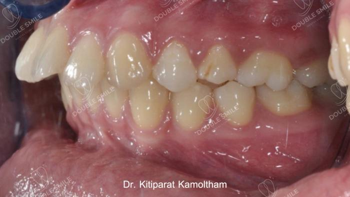 เคสรีวิวที่ 40