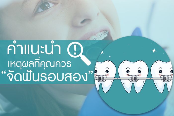เหตุผลที่คุณควร “จัดฟันรอบสอง”