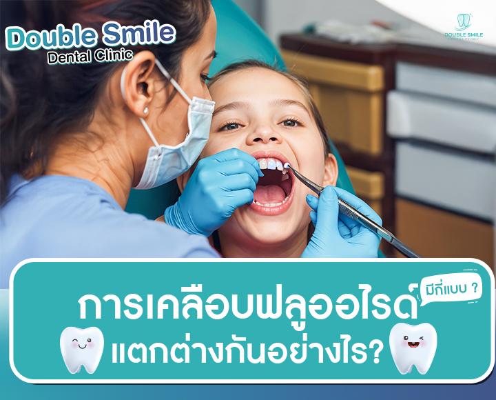 การเคลือบฟลูออไรด์ มีกี่แบบ ? แตกต่างกันอย่างไร?