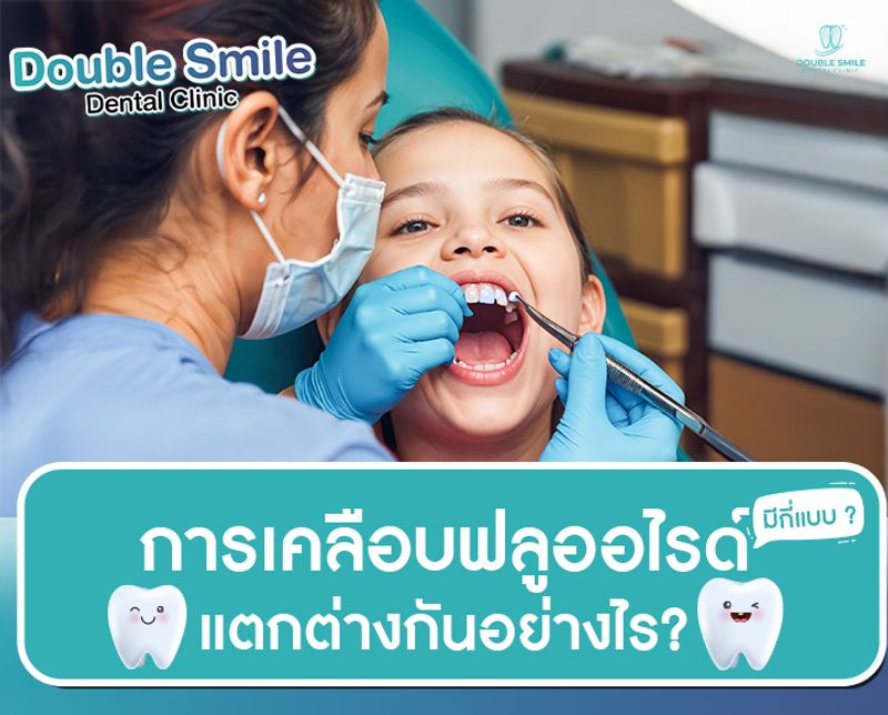 การเคลือบฟลูออไรด์ มีกี่แบบ ? แตกต่างกันอย่างไร?