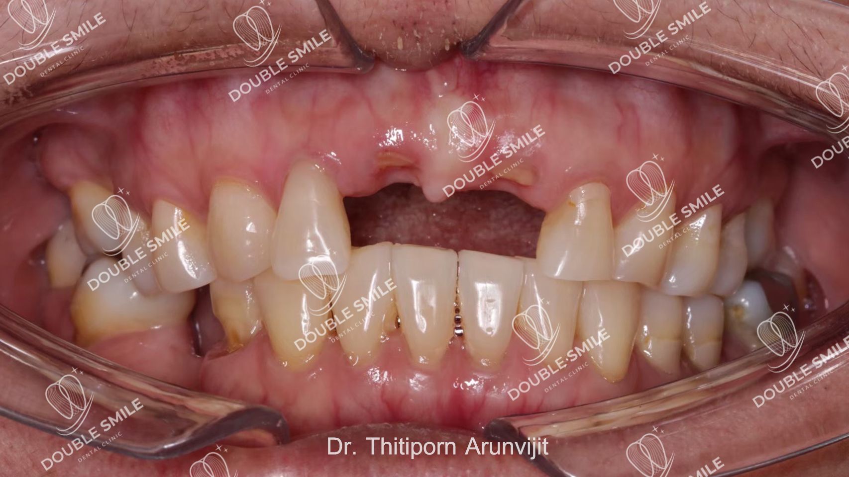 4cce0abd9ce948321dcf9a451949d4decb5bdb76-1706x960.jpg?q\u003d75\u0026fit\u003dclip\u0026auto\u003dformat