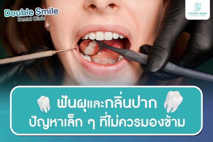 ฟันผุและกลิ่นปาก ปัญหาเล็ก ๆ ที่ไม่ควรมองข้าม