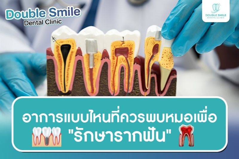 อาการแบบไหนที่ควรพบหมอเพื่อ "รักษารากฟัน"
