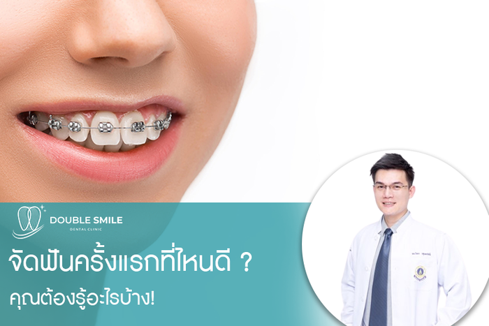 จัดฟันครั้งแรก คุณต้องรู้อะไรบ้าง