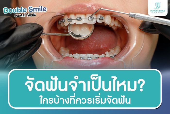  จัดฟันจำเป็นไหม ใครบ้างที่ควรเริ่มจัดฟัน