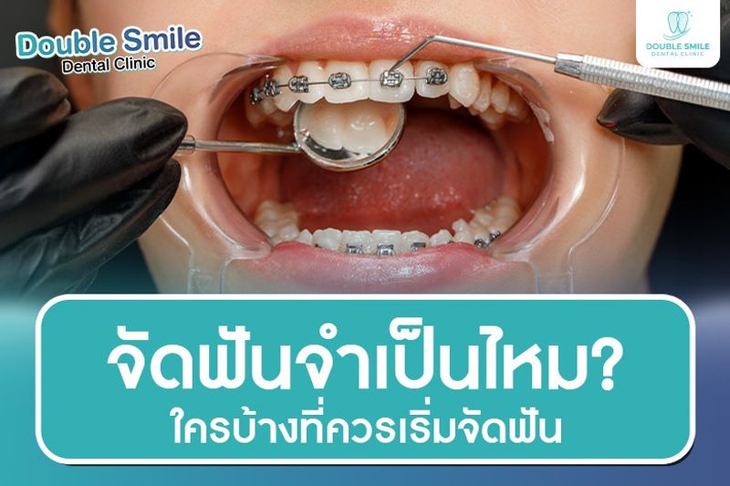  จัดฟันจำเป็นไหม ใครบ้างที่ควรเริ่มจัดฟัน