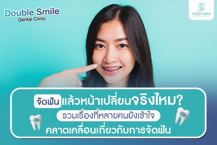 จัดฟันแล้วหน้าเปลี่ยนจริงไหม? รวมเรื่องที่หลายคนยังเข้าใจคลาดเคลื่อนเกี่ยวกับการจัดฟัน