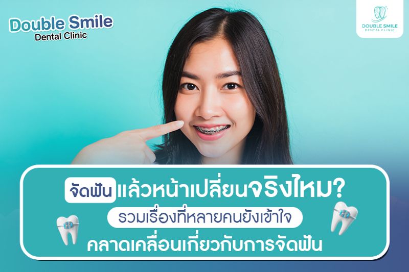 ฟันห่างในเด็ก เกิดจากอะไร? รวมสาเหตุ วิธีสังเกต และแนวทางรักษาที่คุณพ่อคุณแม่ควรรู้