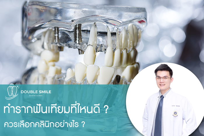 ทำรากฟันเทียมที่ไหนดี ? ควรเลือกคลินิกอย่างไร ?