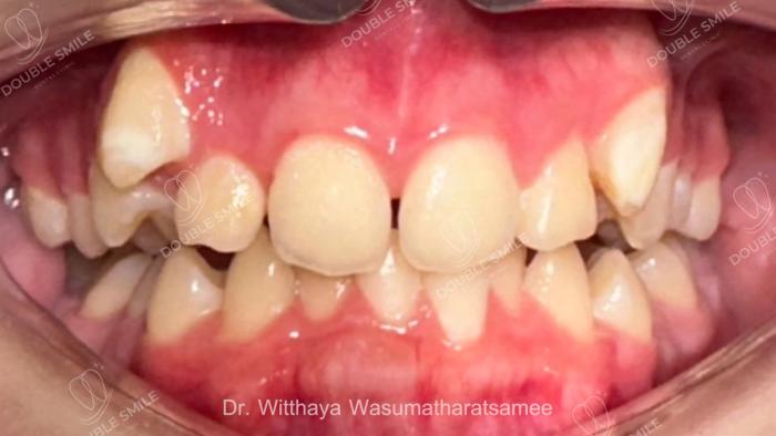 เคสรีวิวที่ 57