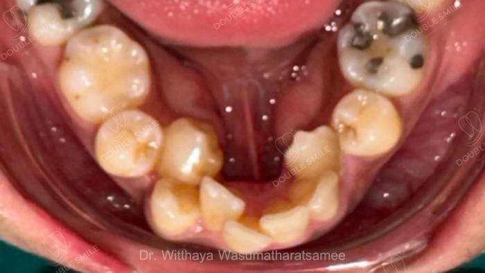 เคสรีวิวที่ 55