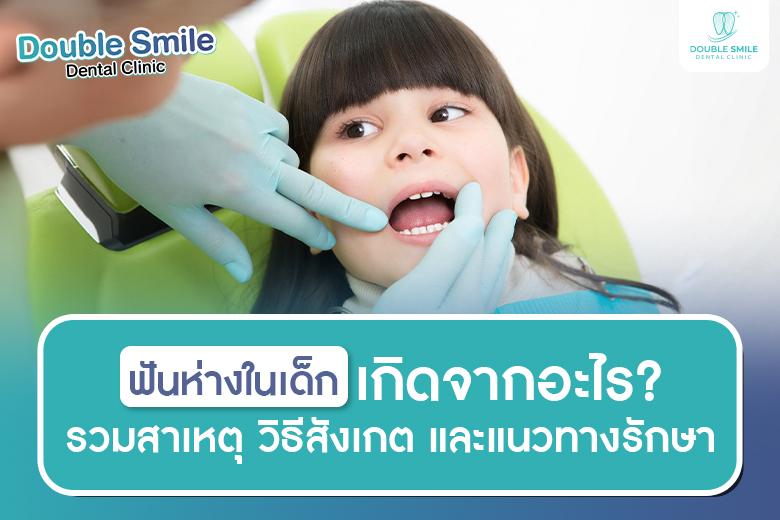 ฟันห่างในเด็ก เกิดจากอะไร? รวมสาเหตุ วิธีสังเกต และแนวทางรักษาที่คุณพ่อคุณแม่ควรรู้