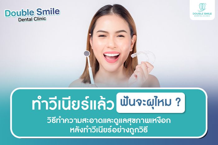 ทำวีเนียร์แล้วฟันจะผุไหม? วิธีทำความสะอาดและดูแลสุขภาพเหงือกหลังทำวีเนียร์อย่างถูกวิธี
