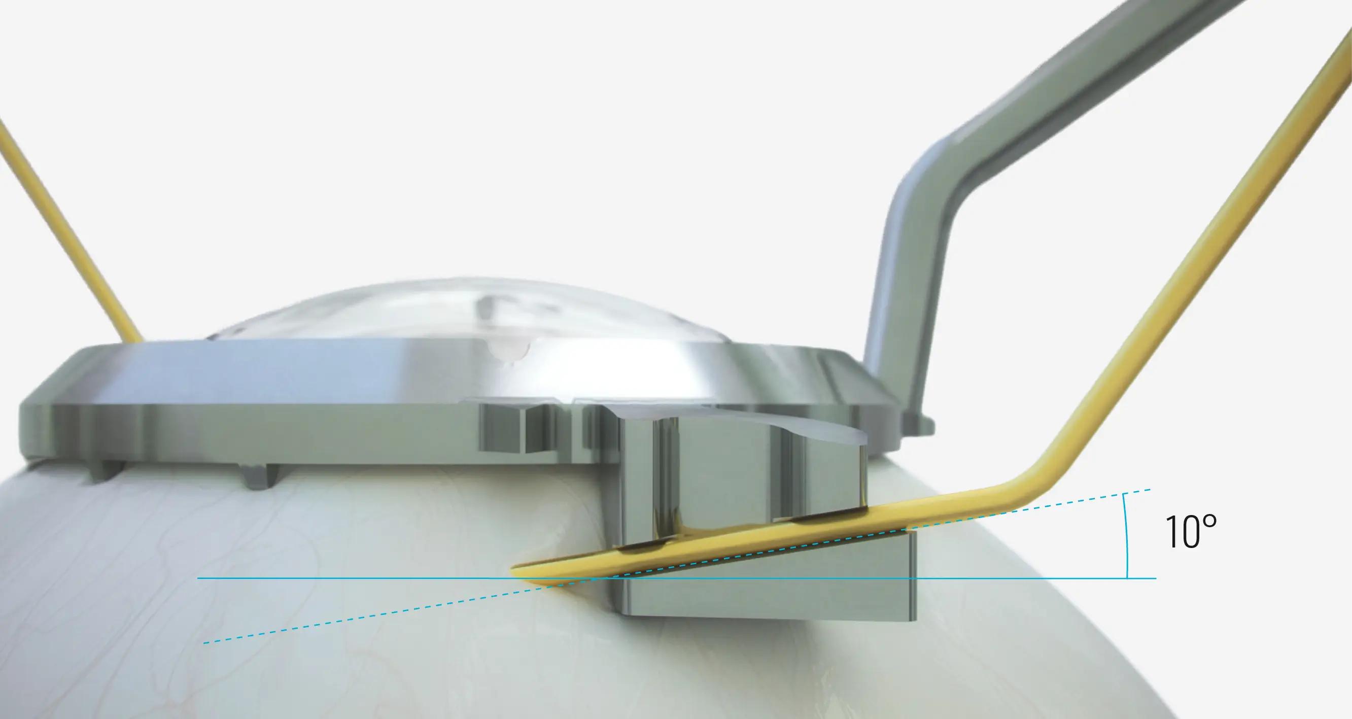 Precise insertion of the cannulas