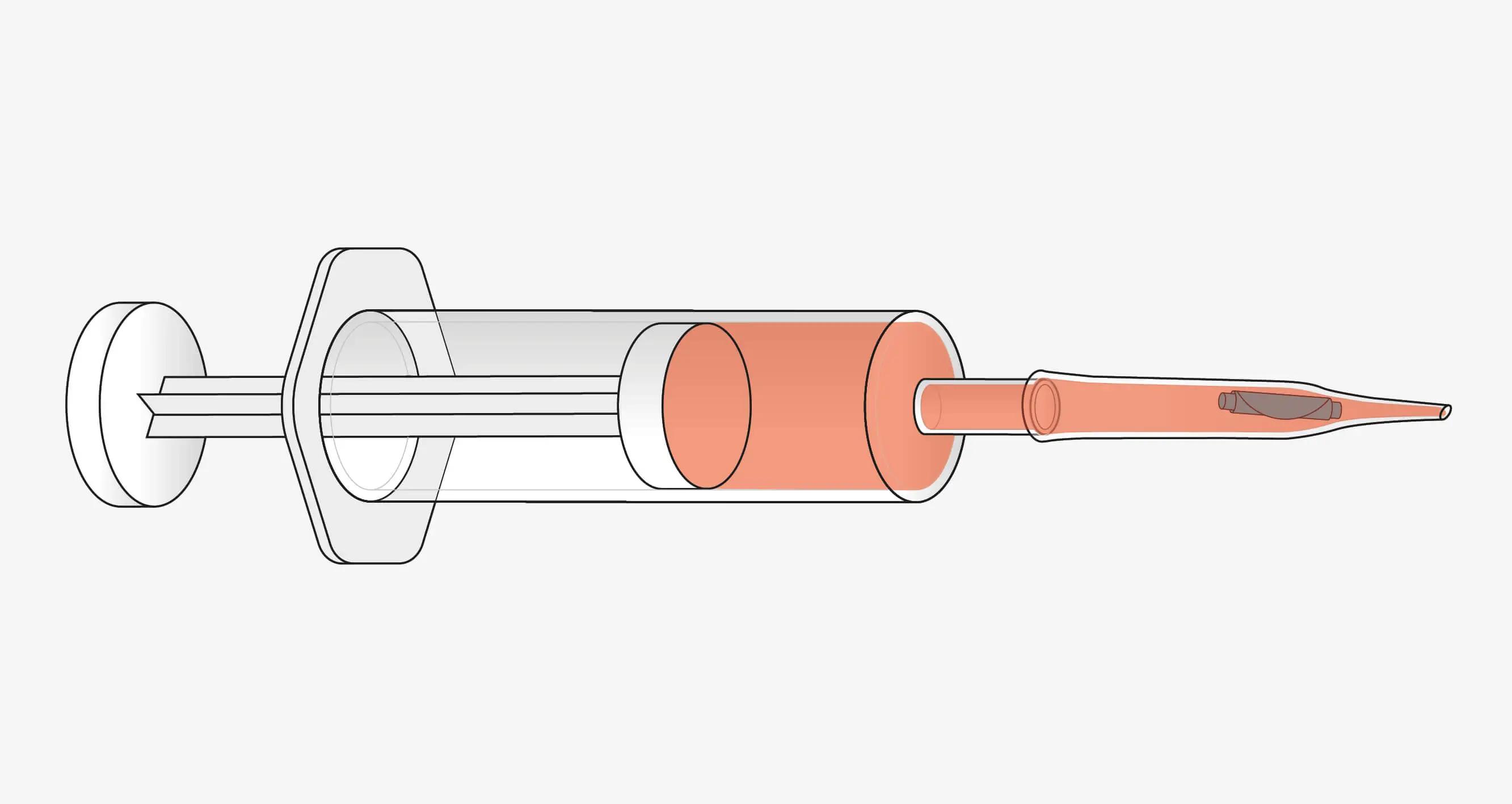 Die Spritze direkt an die große runde Öffnung der Kartusche anschließen. Das Transplantat ist nun bereit zur Injektion.