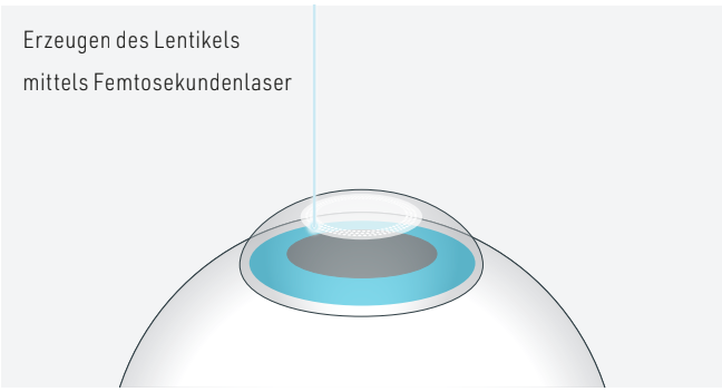 Vorbereitung