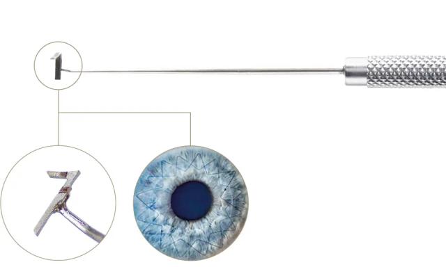 The *Homburg cross-stitch suture marker by Suffo* makes symmetrical and astigmatism-neutral penetrating keratoplasty possible even for less experienced surgeons.