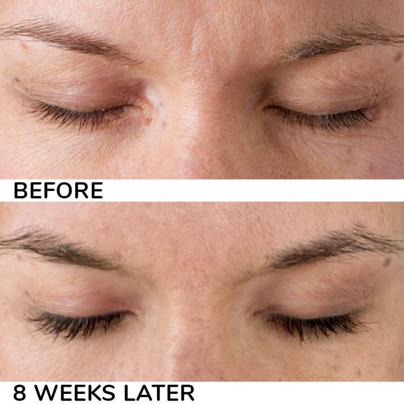 before and after images of eyelash growth