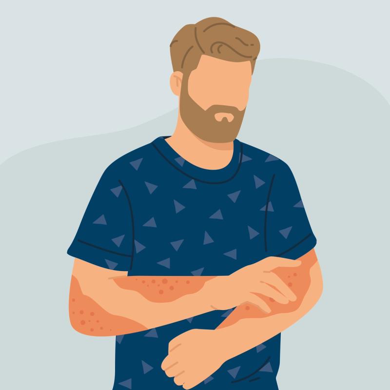An illustration of a person, with a concerned body posture, suffering from skin rash. 
