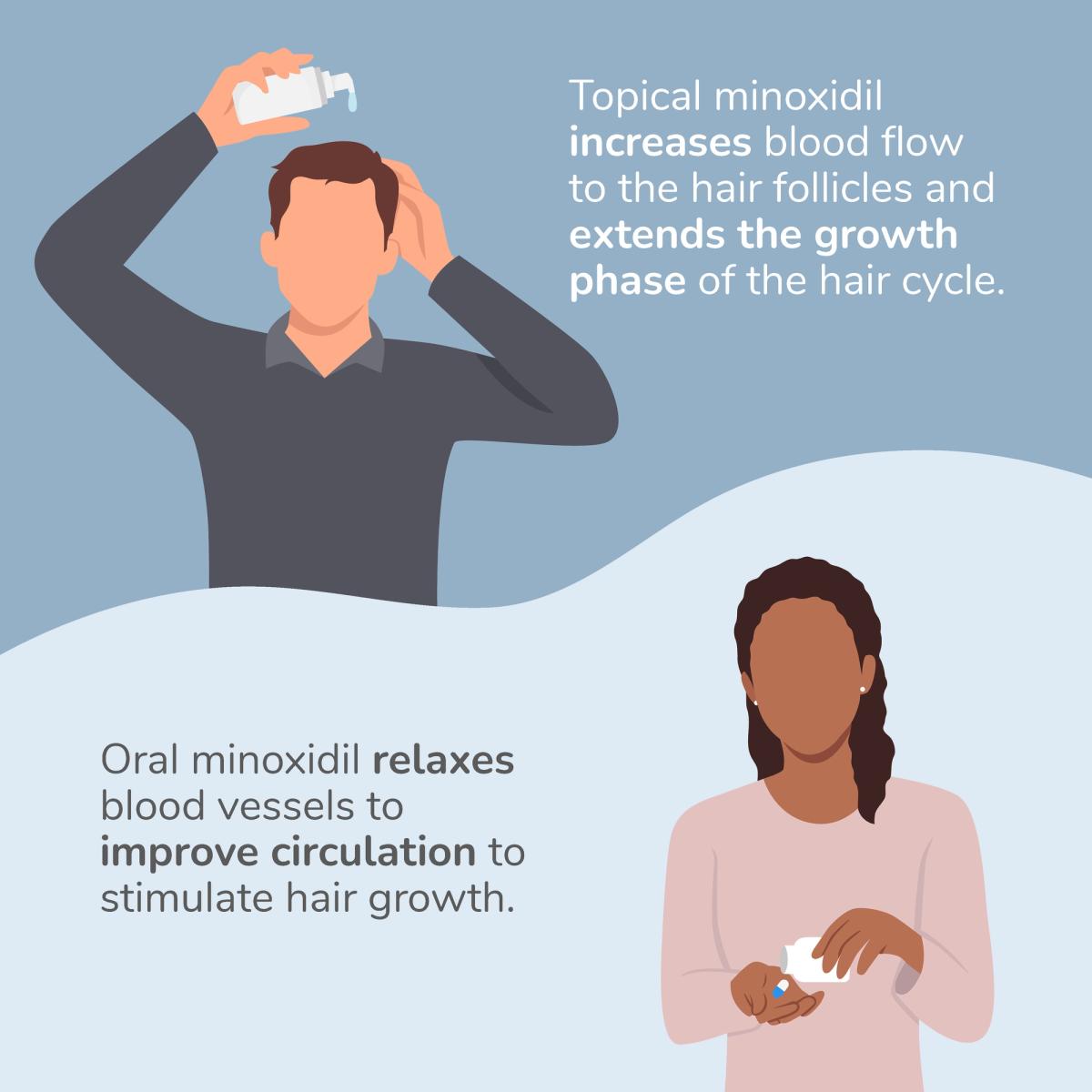 how topical and oral minoxidil work