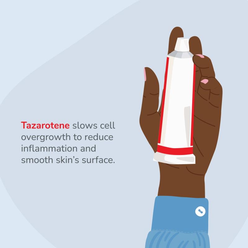 Illustration describing how Tazarotene works