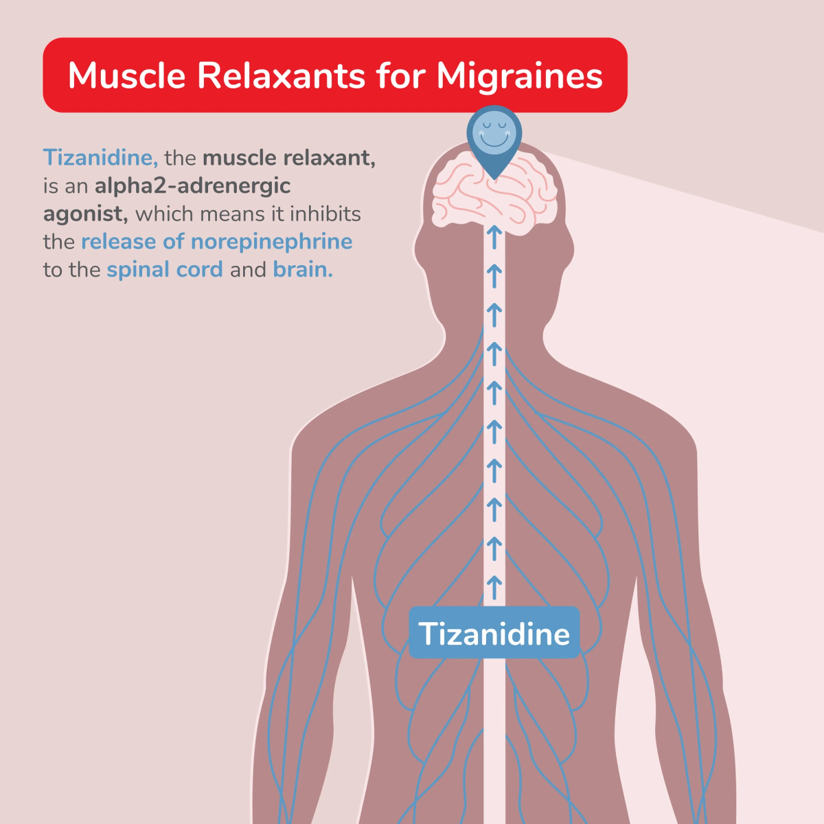 Illustration of Tizanidine Inhibiting the Release of Norepinephrine to the Spinal Cord and Brain