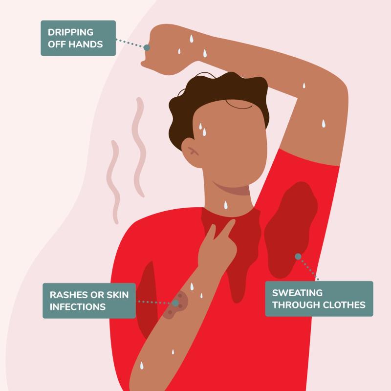 Illustration of Hyperhidrosis Symptoms: Dripping Off Hands, Sweating Through Clothes, Skin Rashes