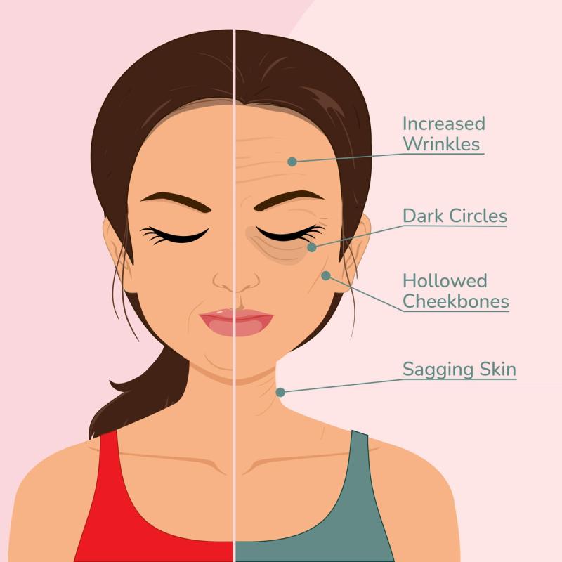 Illustration of a woman with signs of aging on half of her face to show what Ozempic face might look like