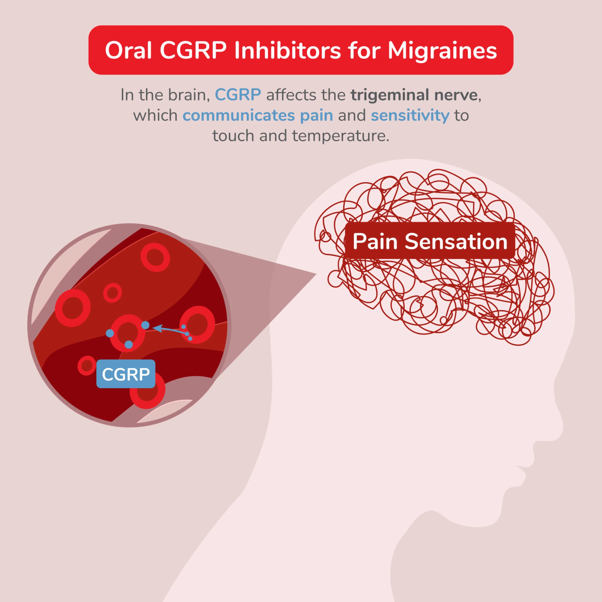Illustration of CGRP Inhibitors for Migraines Affecting the Trigeminal Nerve 